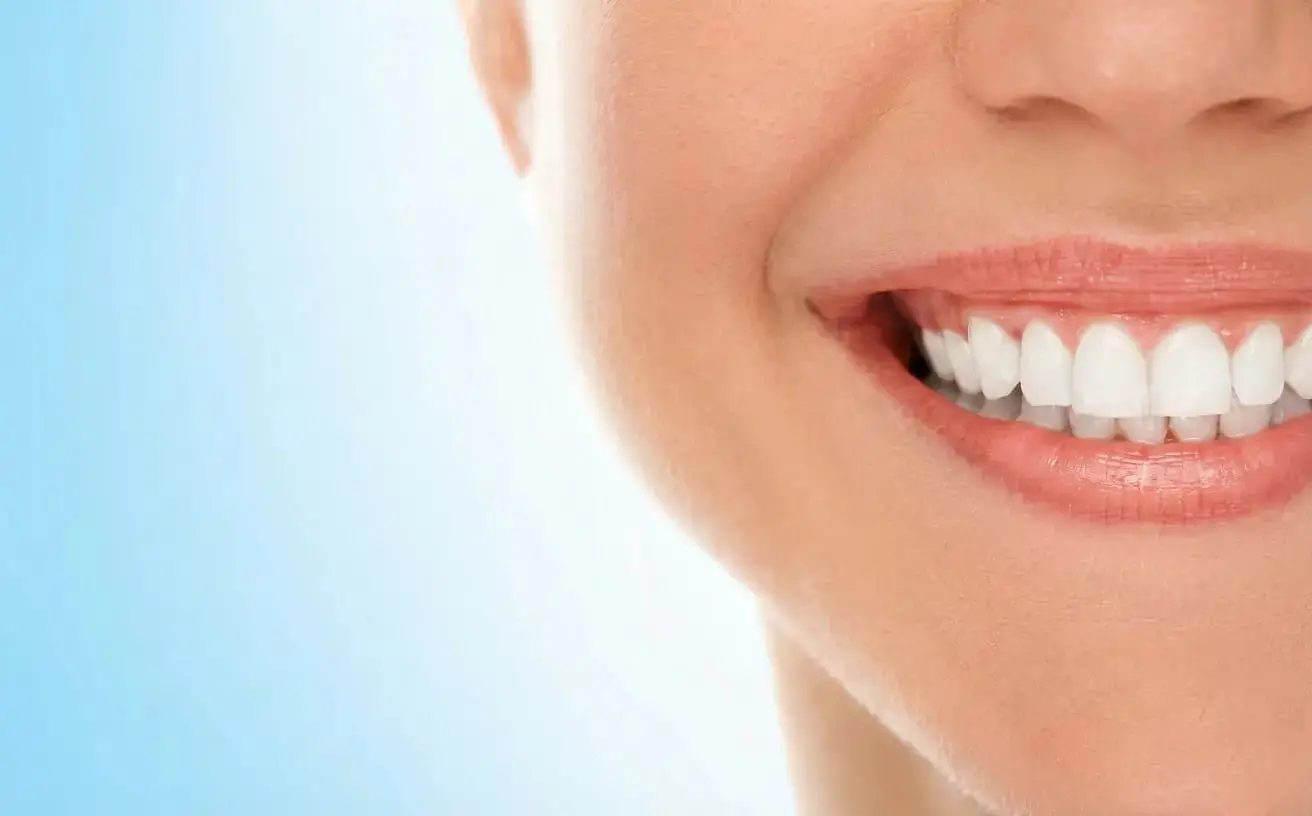 Smile Makeover Transformation