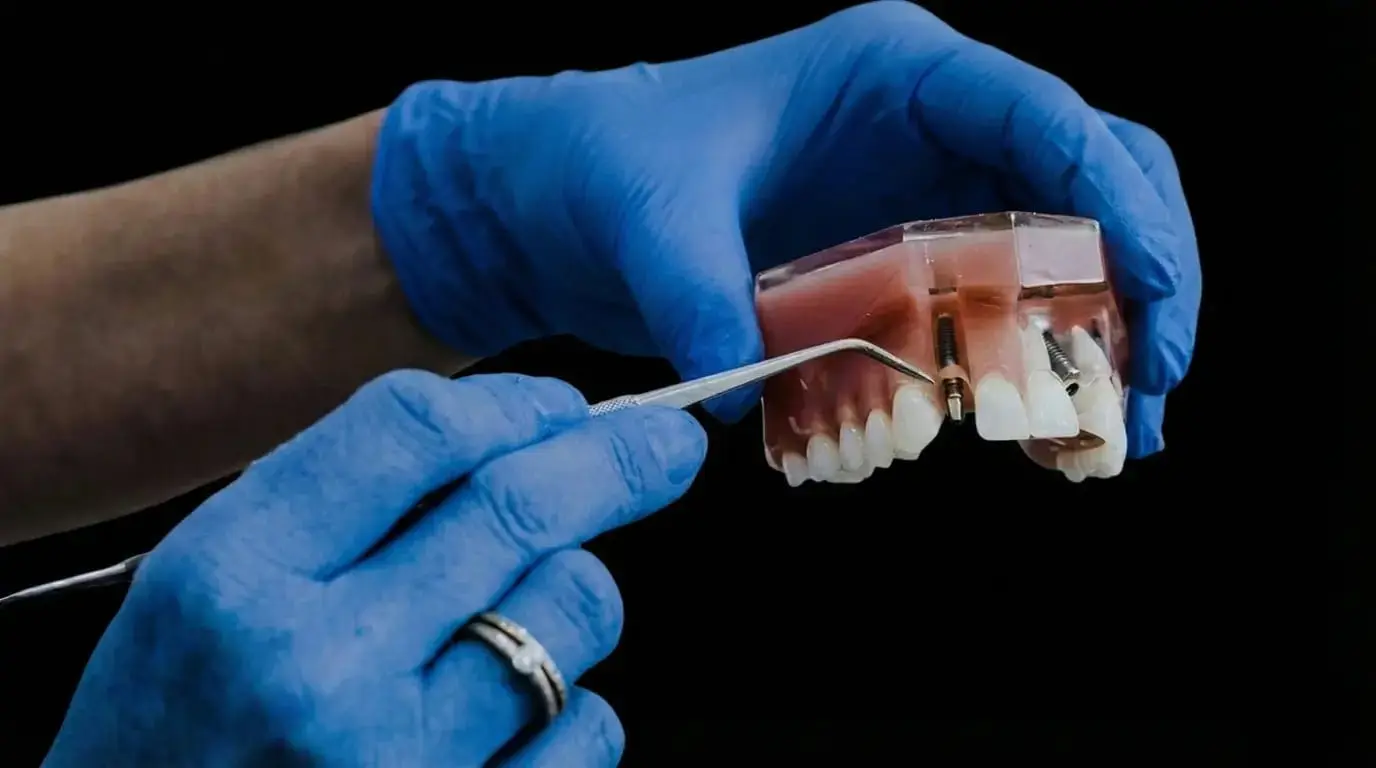 Dental Implants in Antalya, Turkey - Restore Your Smile - High Success Rate Implant Treatment