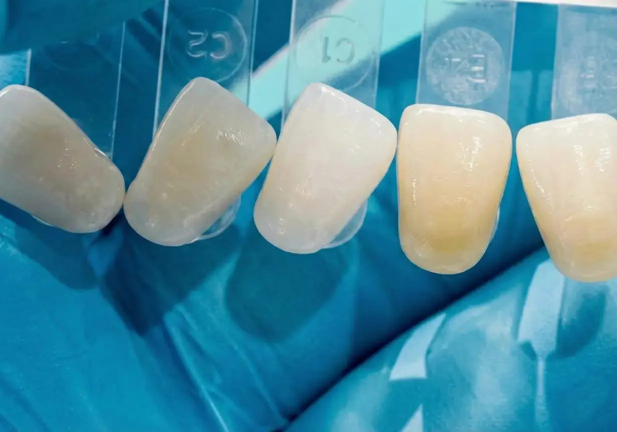 Dental Crowns Treatment