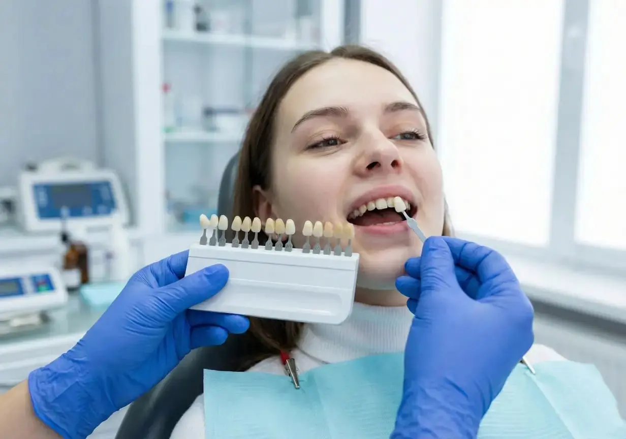 Dental Veneers Before After