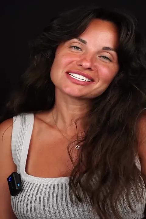 Testimonial: Almanya Hollywood Smile Dönüşümü