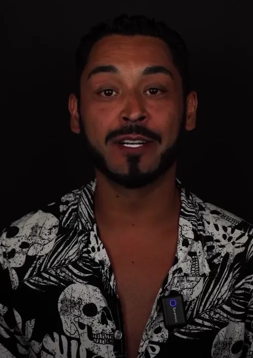 Testimonial: İspanya All-on-6 İmplant Tedavisi