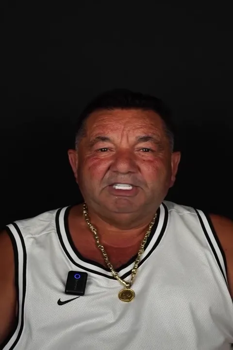 Testimonial: İngiltere All-on-6 Gülüş Tasarımı